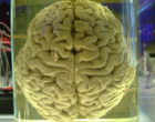 brain